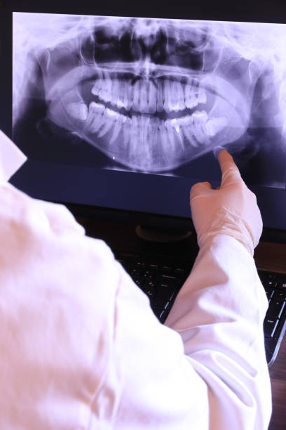 Best Emergency Root Canal Treatment in Citronelle, AL