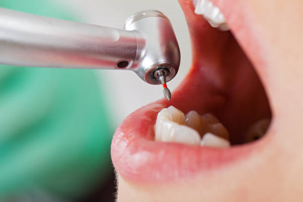 Best Emergency Dental Surgery in Citronelle, AL